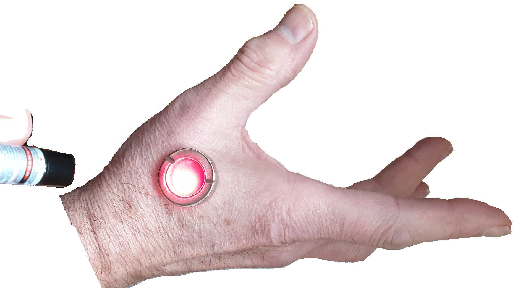 Red later and magnet treatment on an acupuncture point on the hand