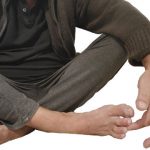 L forefinger R M toe reduced